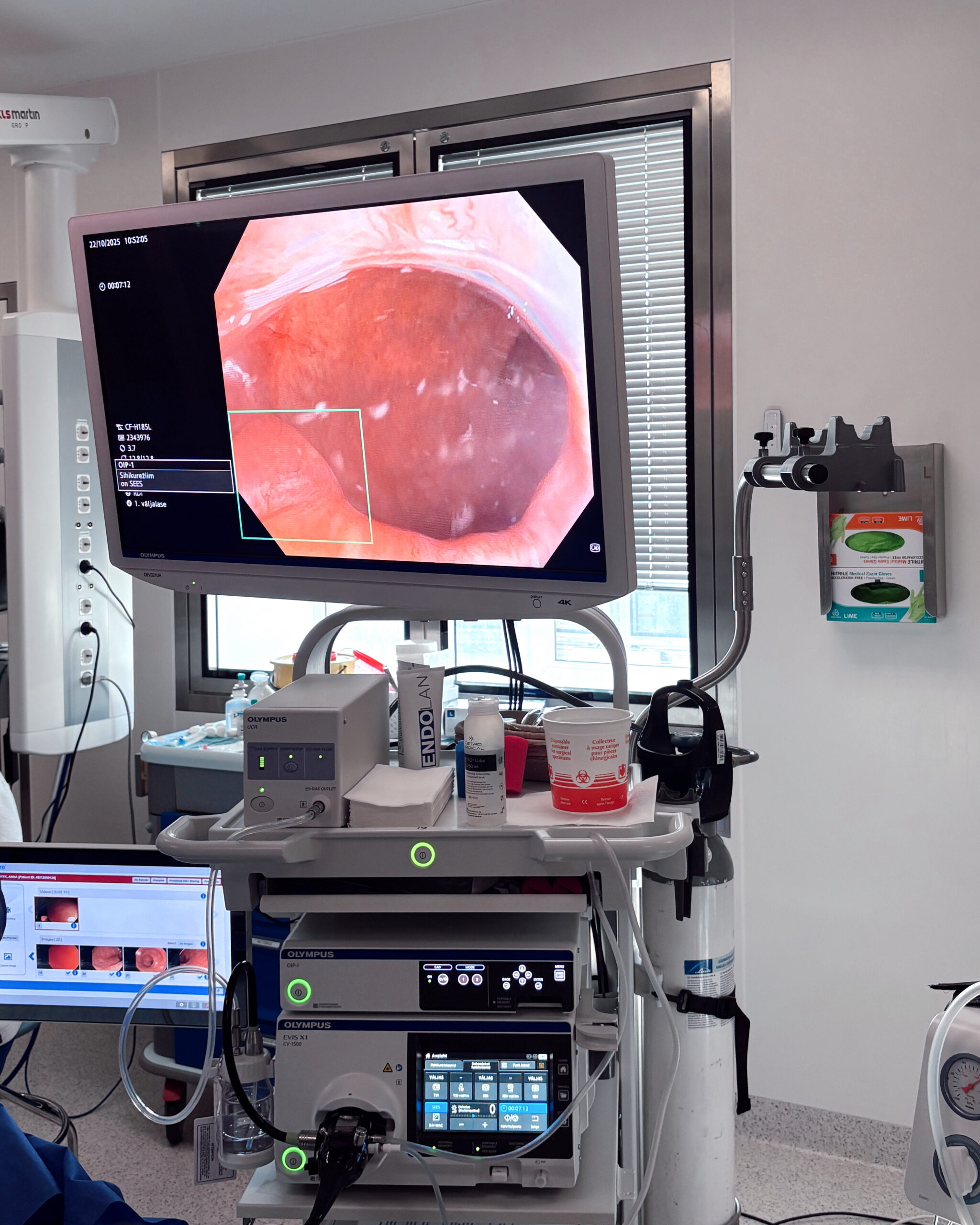 Soolevähi-sõeluuring